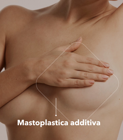 Mastoplastica Additiva