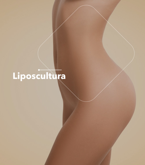 Liposuzione