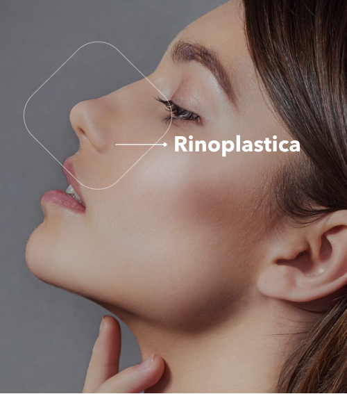 Rinoplastica