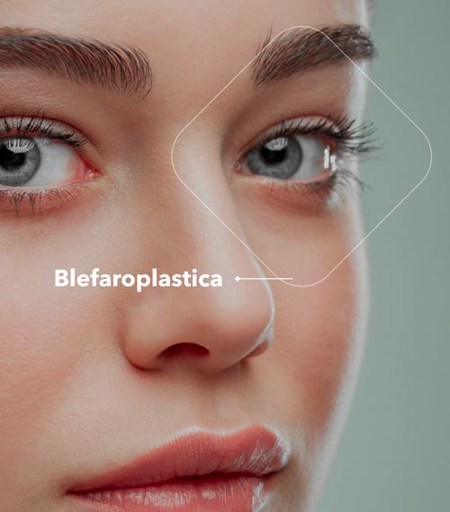Blefaroplastica